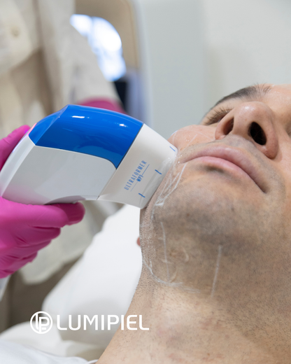 Reducción de Papada con Equipo HIFU - Ultraformer MPT®