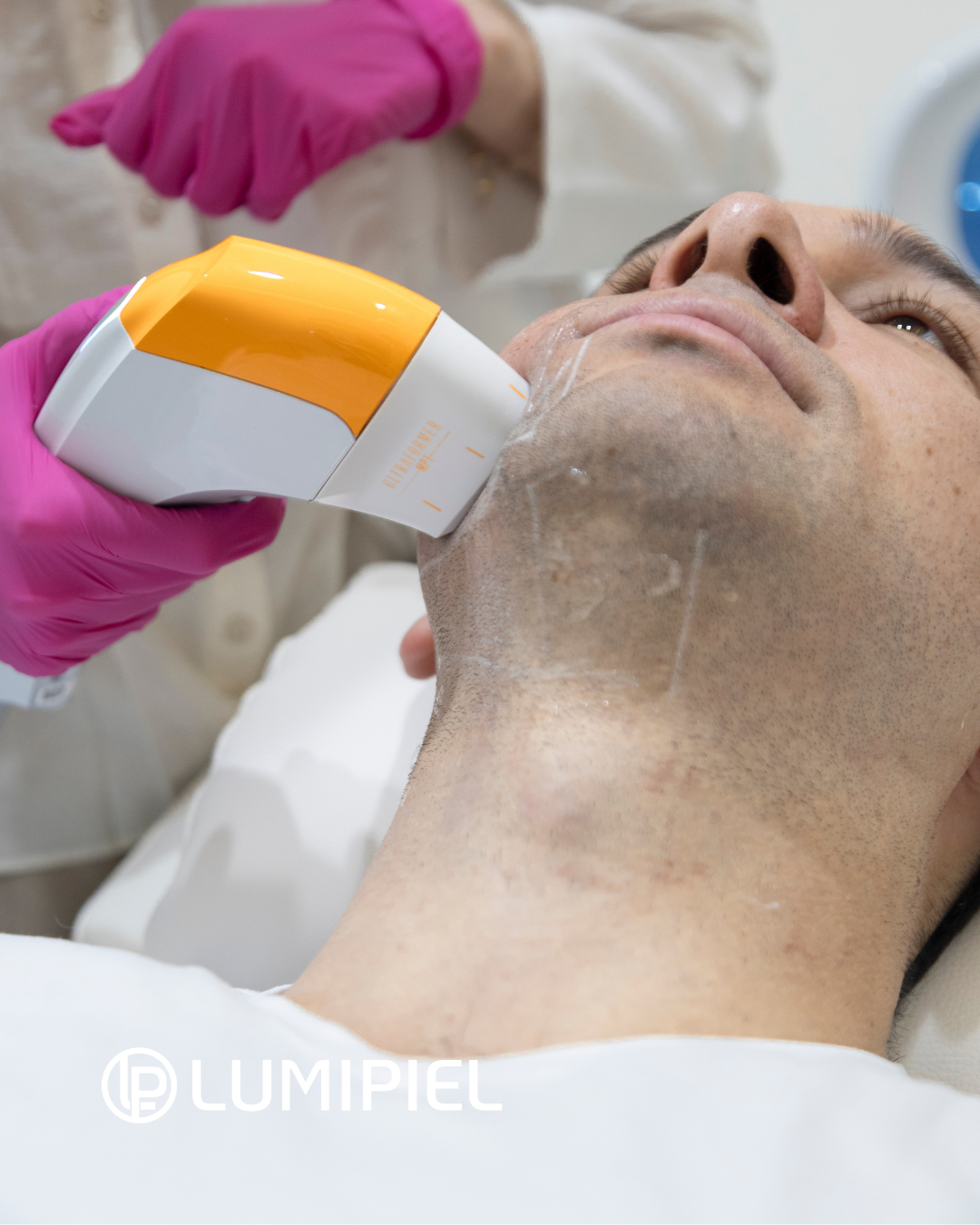 Reafirmación de Cuello con equipo HIFU - Ultraformer MPT®
